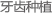 牙齿种植