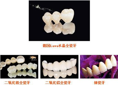 补牙多少钱